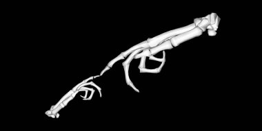 Çekme kemiği ön kolu birbirine üç boyutlu olarak dokunuyor.