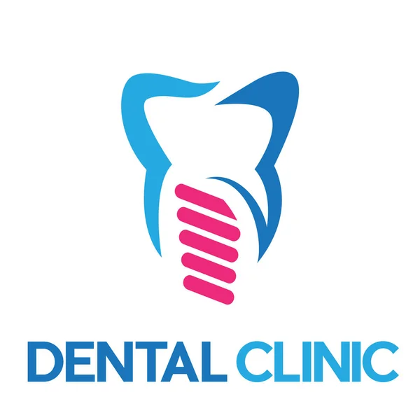 Implante Dental Abstracto Vectorial Tornillos Dientes — Archivo Imágenes Vectoriales