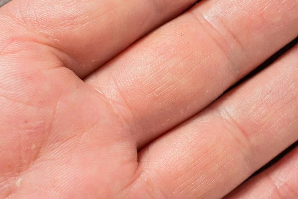 Cilt kırışıklıkları olgun erkek vücudunda ile doku