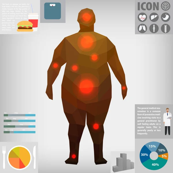 肥満の人 インフォ グラフィック ベクトル イラスト — ストックベクタ
