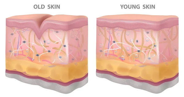 肌の若い古いしわ 現実的な図面 構造ベクトル図 — ストックベクタ