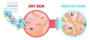 Dry skin enriched with vitamins, nutrition. Healthy skin. Vector clipart