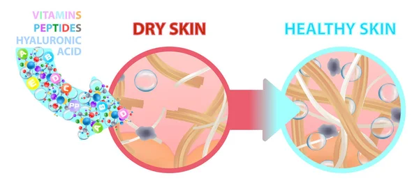 Peaux sèches enrichies en vitamines, nutrition. Une peau saine. Vecteur — Image vectorielle