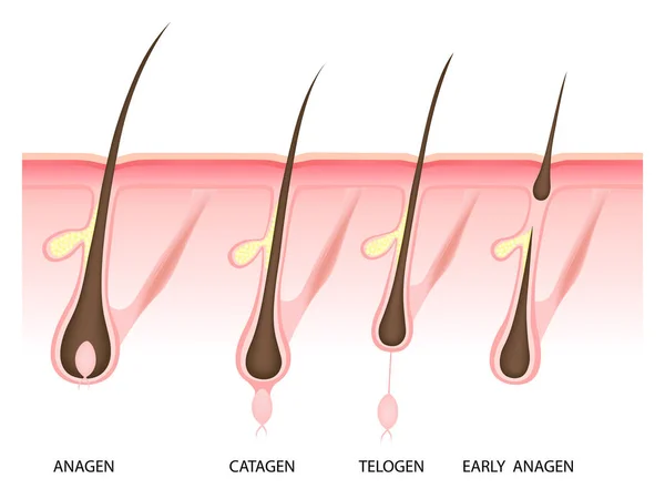 Fase de crescimento do cabelo, ilustração vetorial — Vetor de Stock