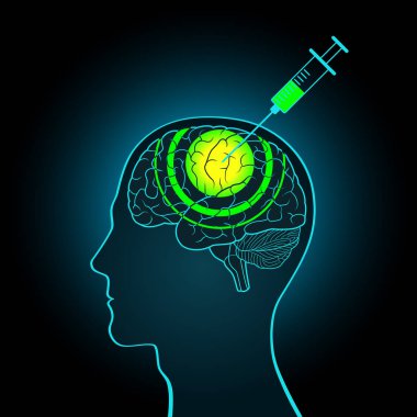 Doğruluk serumunun beynine enjeksiyon şırınga, beyin yıkama. Sorgulama, doğru bilgi alma, yeni veri yapma