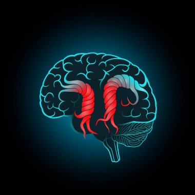 Beyin, inme, hafıza imha ile bükülmüş convolutions ile Brain,