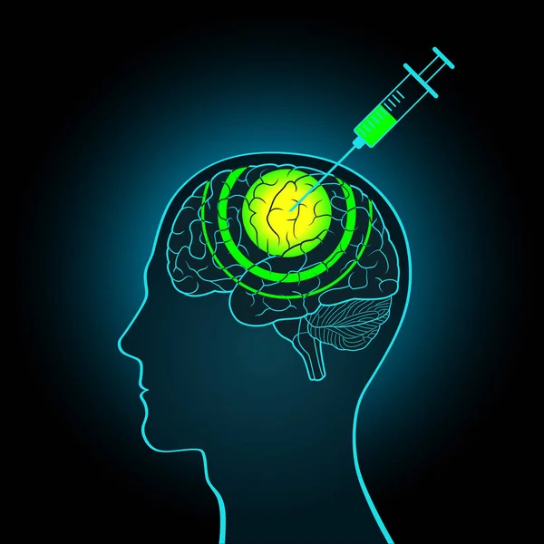 Doğruluk serumunun beynine enjeksiyon şırınga, beyin yıkama. Sorgulama, doğru bilgi alma, yeni veri yapma