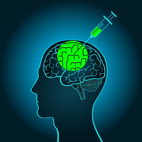 Injektion einer Spritze in das Gehirn eines Wahrheitsserums, das Kurven begradigt, Gehirnwäsche durchführt, blinkt — Stockvektor
