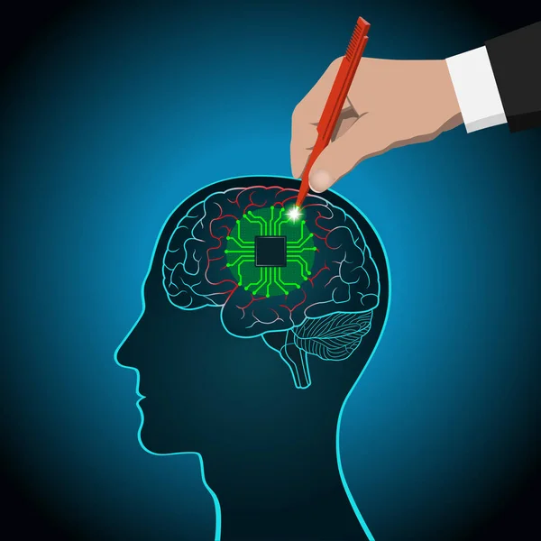 Restauração das funções cerebrais, próteses de áreas afetadas, mente, consciência, memória, tratamento cirúrgico de doenças cerebrais —  Vetores de Stock
