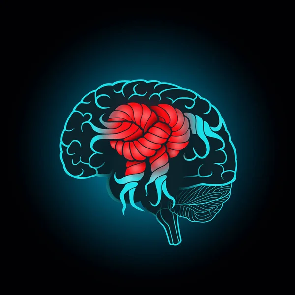 Cerebro con convoluciones asociadas al nudo, el concepto de la recuperación del cerebro, memoria, accidente cerebrovascular — Vector de stock