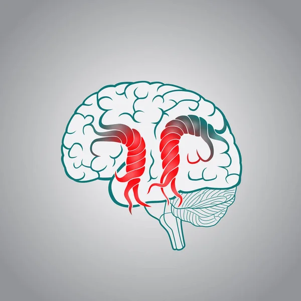 Cerveau avec les convolutions tordues, de la destruction du cerveau, accident vasculaire cérébral, mémoire — Image vectorielle