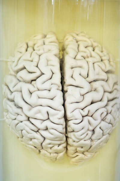 Human brain in formalin solution closeup, medical research
