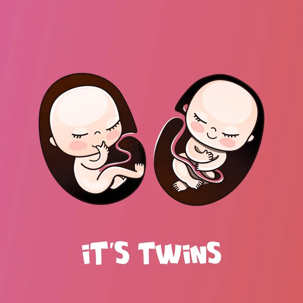 Yazıt ile İlerleme bar - Twins yükleme ve yeni doğan kızlar — Stok Vektör