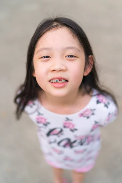 Σιδεράκια στα δόντια της μικρά Ασίας παιδί. — Φωτογραφία Αρχείου