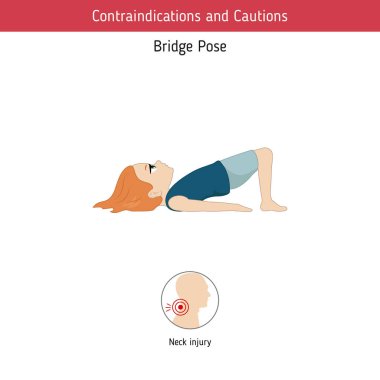 Yoga Infographics poz. Kontrendikasyonlar konusunda köprü Yoga poz. Karikatür tarzı illüstrasyon izole beyaz arka plan üzerinde.