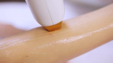 Yakın çekim yordamı kıllar el kaldırma. Lazer epilasyon diode lazer üzerinde