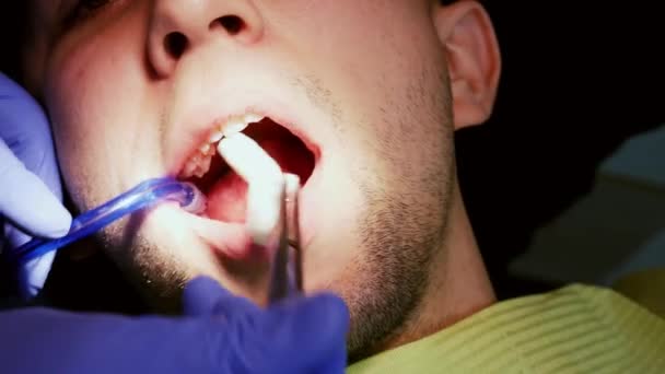 Le dentiste tient l'outil pour nettoyer les dents d'un jeune homme. Patient en clinique dentaire . — Video