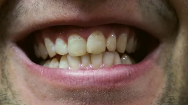 Close up of smiling man teeth at the dentists reception. — Stock Video