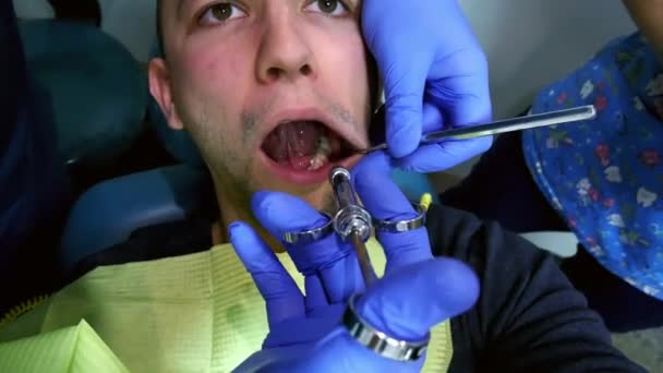 Injeção de anestesia de perto no dente do paciente. Homem com boca aberta durante o procedimento dentário — Vídeo de Stock