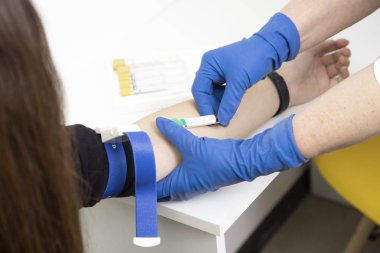 AIDS için test olsun