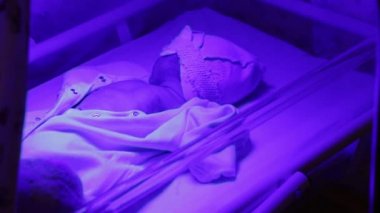 Yeni doğan bebek ultraviyole lamba altında. Bebeklerde yüksek bilirubin tedavisi