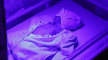 yeni doğan ultraviyole lamba altında.