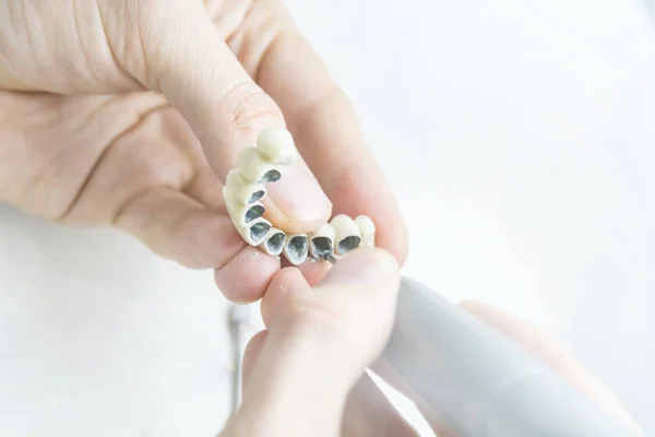 Dental technician tooth prosthetic makeing in laboratory