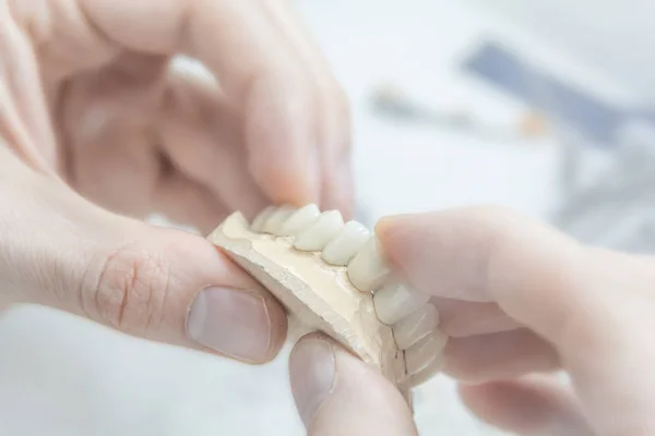 Technicien Dentaire Médical Tenant Une Prothèse Laboratoire — Photo