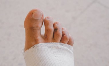 bandajlı adamın bacak yakın çekim