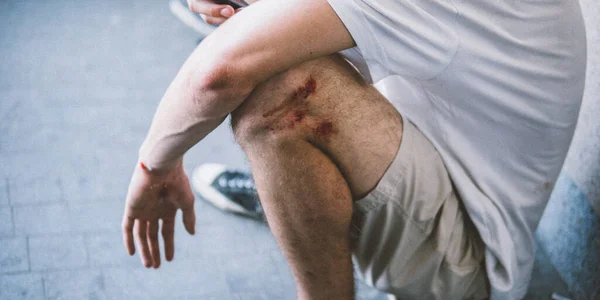 Día Internacional Del Skateboarding Montaje Patinadores Plaza Principal Para Popularizar —  Fotos de Stock