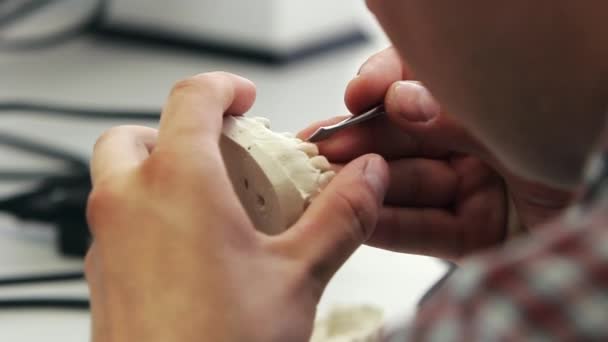 Zahnarzt stellt eine Zahnimplantat-Prothese aus Gips her. Orthopädische Zahnheilkunde, Prothetik. Smile Design Artist arbeitet an Zähnen. — Stockvideo