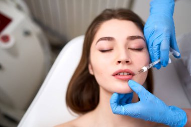 Dudak Büyütme. Beautician Doktor Eller Şırınga ile Kadın Dudakları için Güzellik Prosedürü Yapıyor Closeup. Hyaluronik Asit Enjeksiyonu Alan Genç Kadınlar Ağız. Kozmetoloji Tedavisi. Dolgu Terapisi.