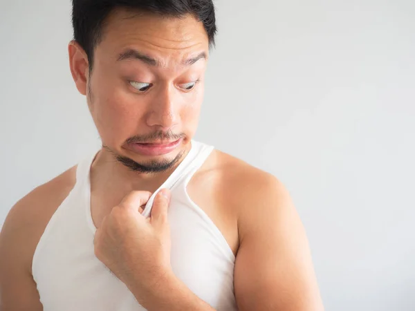 Shock face of Asian man get ugly tanned on the shoulder.