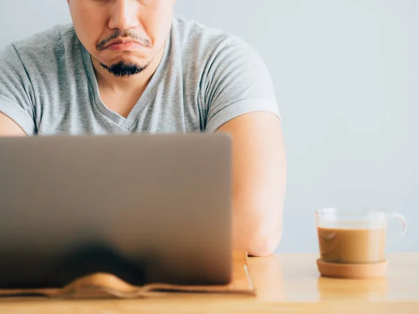 Serious Boring Face Asian Man Work Laptop — Stock Photo, Image