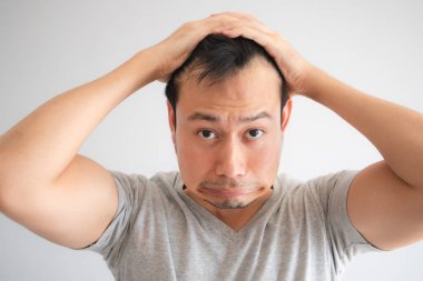 Asyalı adamın şok yüzü kendini saç larını kaybetmiş bulmak ve kel olsun.