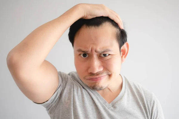 Asyalı adamın şok yüzü kendini saç larını kaybetmiş bulmak ve kel olsun.