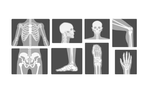 Креативна Радіологія Скелетні Кістки Вектор Реалістичний Рентгенівський Логотип Дизайн Ілюстрація — стоковий вектор