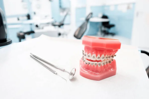 dental model with braces - Teeth orthodontic dental model with d