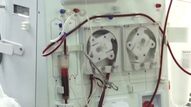 Hemodiyaliz makinesi. blood_converted extrarenal Gümrükleme