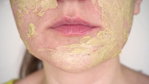 Γυναίκα με πρόβλημα του δέρματος κάνει τη φροντίδα εφαρμόσει μια διάστικτη φυσική μάσκα της πράσινης άλγης σε ακμή σε ένα σπυράκι — Αρχείο Βίντεο