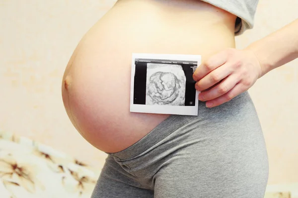 Pregnancy ultrasound scan. Pregnant woman holding ultrasound scan on her tummy. Teenage pregnancy.