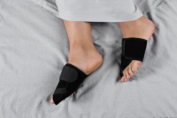 Woman foot bunion protection. Bunion corrector