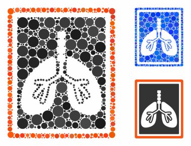 Akciğerler x-ray fotoğraf bileşimi Çemberlerin Simgesi