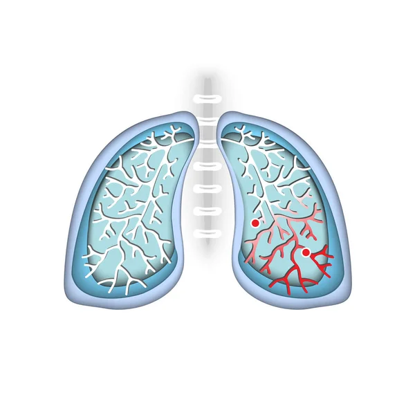 Simbolo Malattia Polmonare Respira Sistema Respiratorio Malattie Respiratorie Cancro Asma — Vettoriale Stock