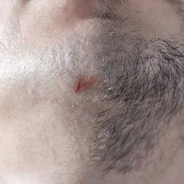 Male half-shaved chin with a razor cut close-up. — Stock Photo, Image