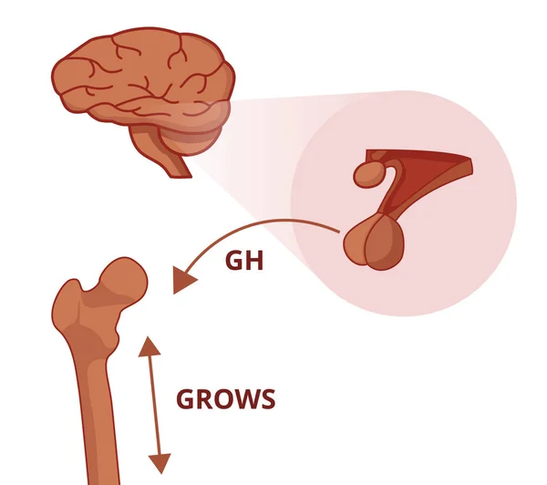 Pitutary Bezi Büyüme Hormonu Üretiyor Hypophysis Gündüz Hormon Bir Kemik — Stok Vektör