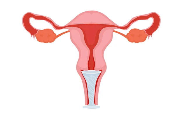 Preservativo femminile in utero — Vettoriale Stock