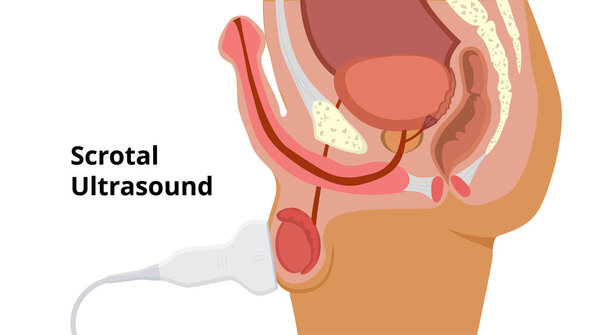 Scrotal ultrasound scan process. Male roproductive system anatomy and examination. Linear probe is placed on the testis