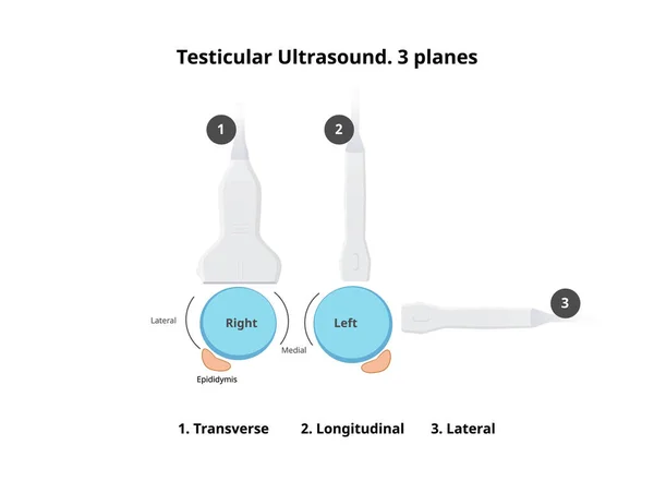 Testis Ultrason Taramasının Şematik Çizimi Düzlemde Testis Yakalayan Doğrusal Dönüştürücü — Stok Vektör