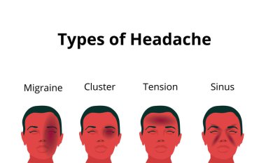 Kafasındaki ağrıdan muzdarip kadının vektör çizimi. Dört çeşit baş ağrısı tasvir ediliyor: migren, gerilim baş ağrısı, sinüs ağrısı ve küme baş ağrısı.